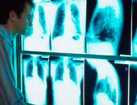 Technician reviews x-rays