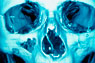 MRI screen